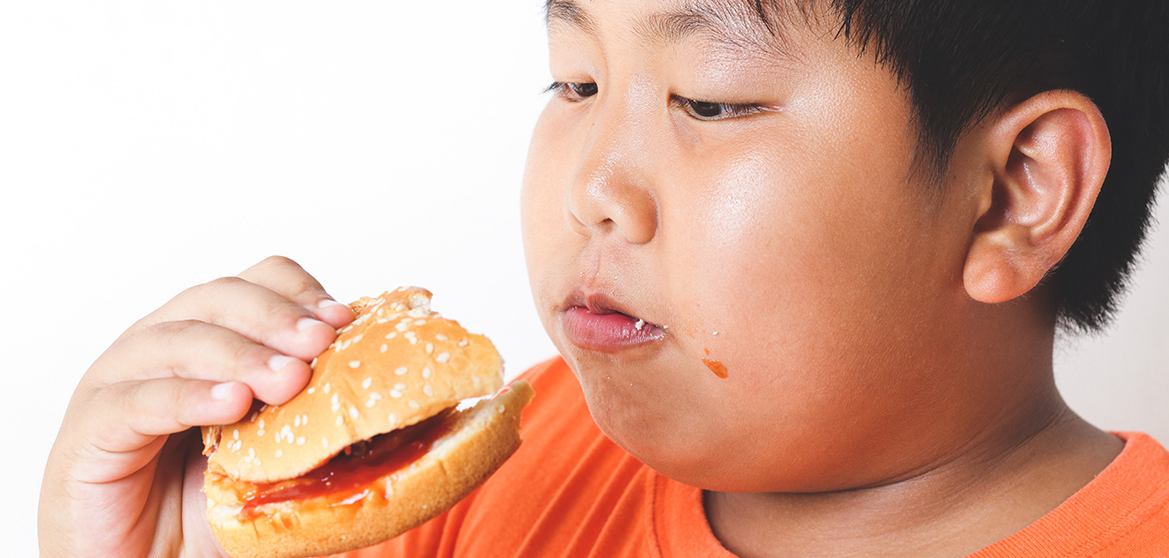 Factors That Cause Childhood Obesity –  Latest Best Research 2022