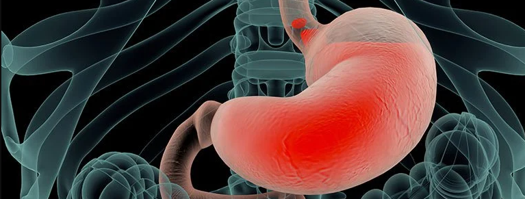 There is a Way To Resolve Indigestion – Latest Research 2022