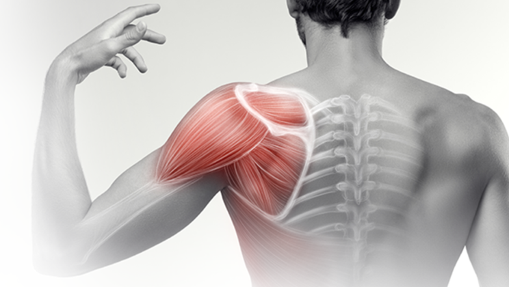 Recognize Shoulder Strain – Latest Research 2022